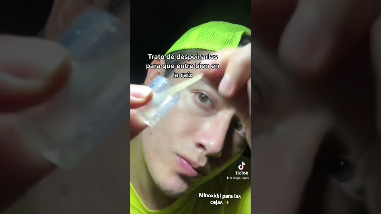 Minoxidil para cejas: aplicación y resultados resultados reales