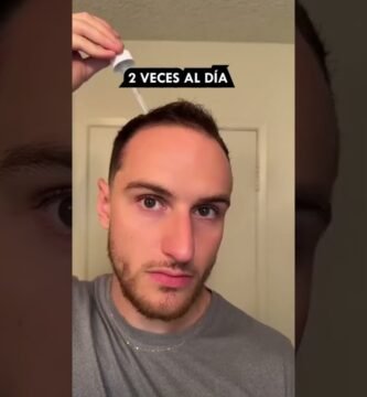 Remedios caseros para la finasteride