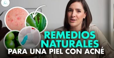 Rutinas de cuidado para prevenir la remedios caseros