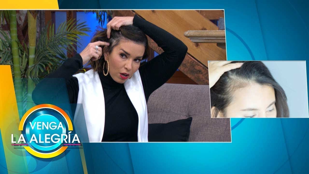 Terapias innovadoras contra la alopecia postparto