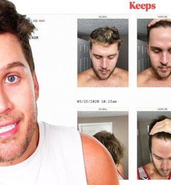 biotina en shampoo para hombres