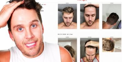 biotina en shampoo para hombres