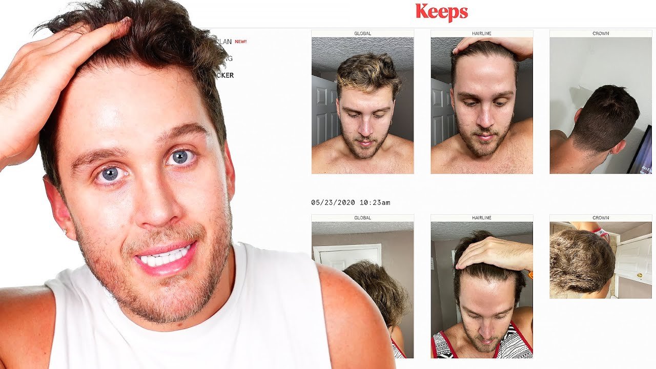 biotina en shampoo para hombres