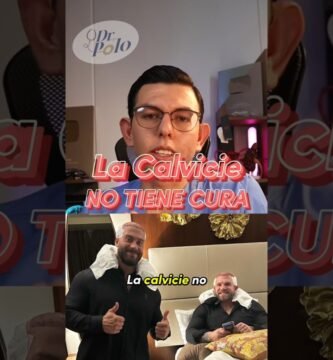 Consejos de expertos sobre la alopecia difusa