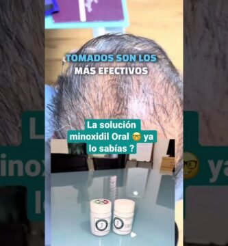 Minoxidil para calvicie femenina: efectividad ofertas
