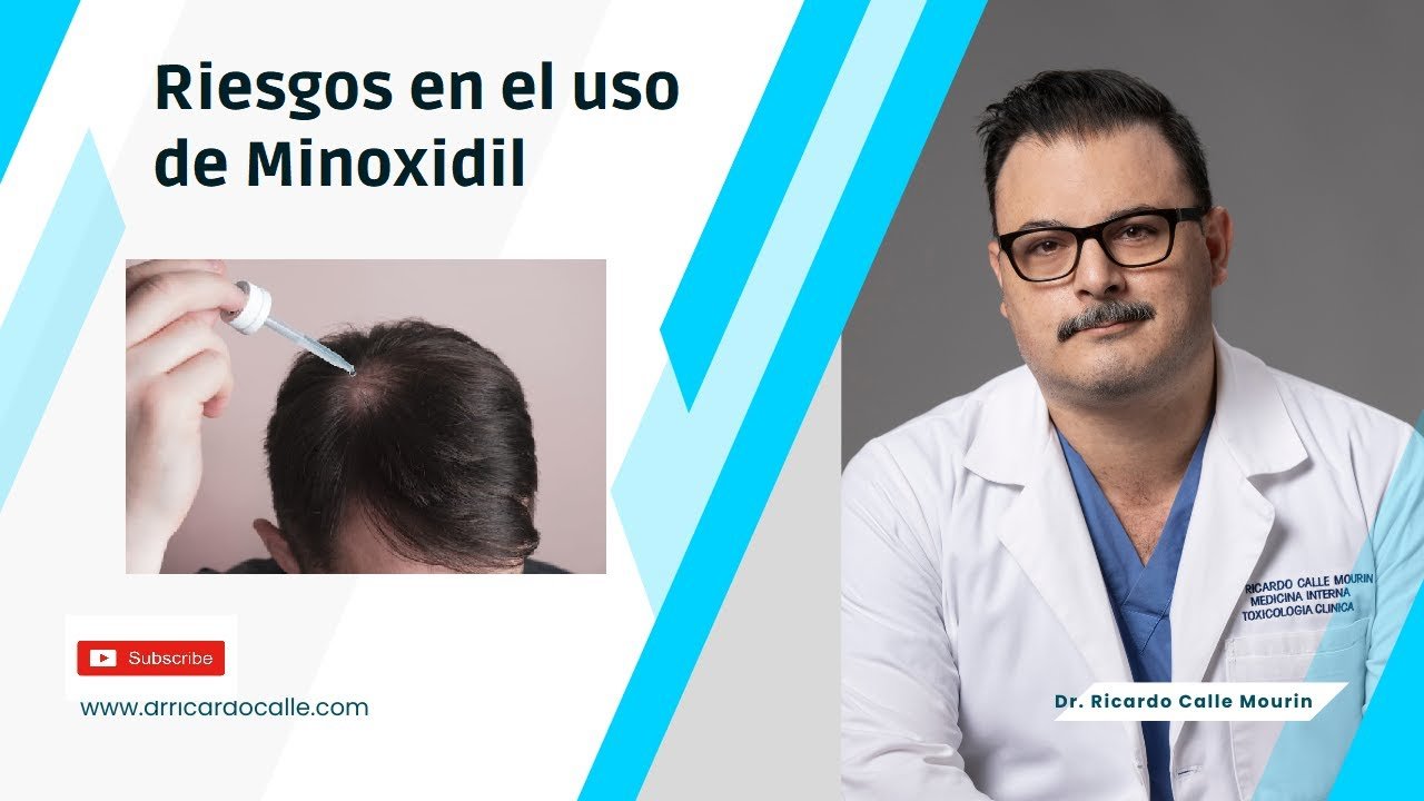 Síntomas comunes de la minoxidil