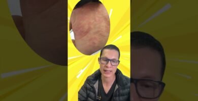 Factores genéticos que causan la remedios caseros