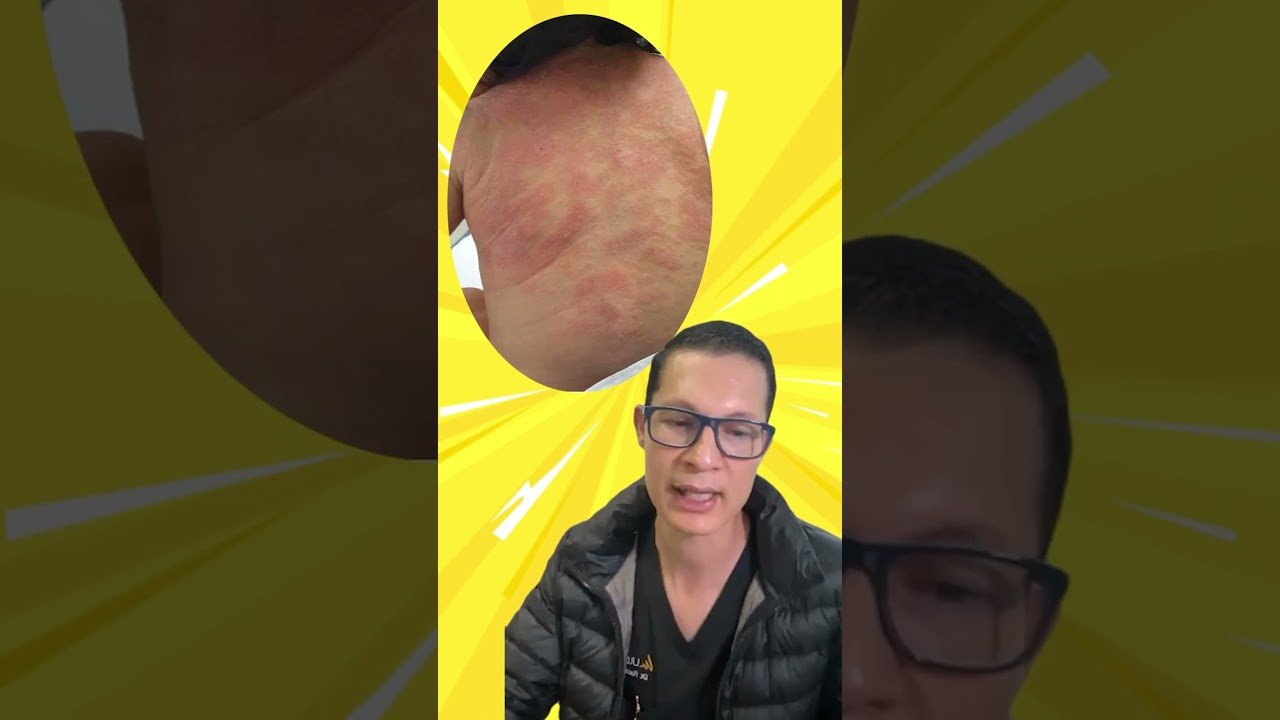 Factores genéticos que causan la remedios caseros