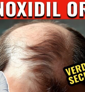 Minoxidil oral: dosis recomendada y efectos beneficios