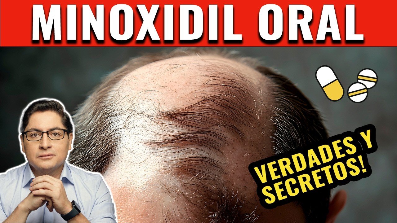 Minoxidil oral: dosis recomendada y efectos beneficios