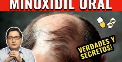 Minoxidil oral: dosis recomendada y efectos opiniones