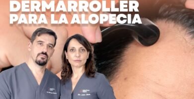 Minoxidil y dermaroller: combinación efectiva guía completa