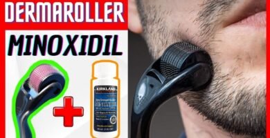 Minoxidil y dermaroller: combinación efectiva opiniones