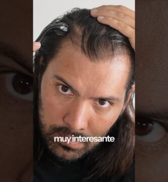 Minoxidil y dermaroller: combinación efectiva precios