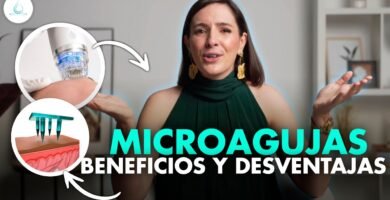 Minoxidil y dermaroller: combinación efectiva pros y contras
