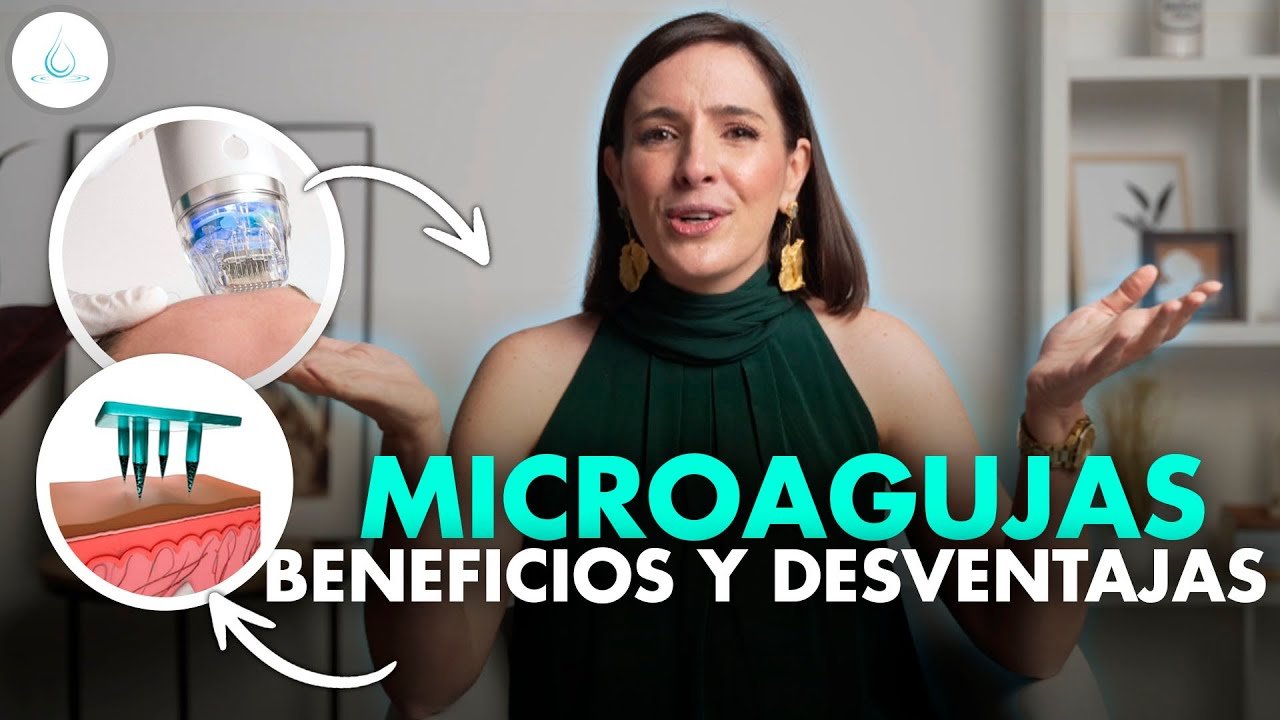 Minoxidil y dermaroller: combinación efectiva pros y contras