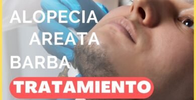 Relación entre alopecia en la barba y estrés