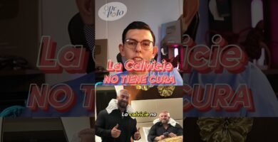 Tratamientos recomendados para la alopecia total