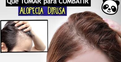 Ejercicios que ayudan con la alopecia difusa