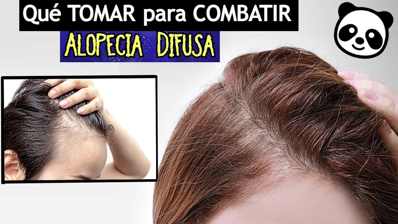 Ejercicios que ayudan con la alopecia difusa