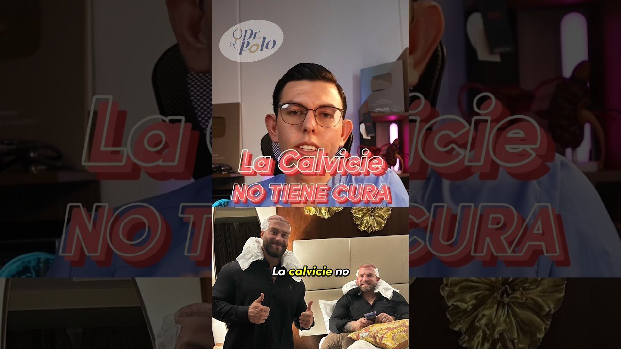 Guía completa sobre la alopecia en la barba