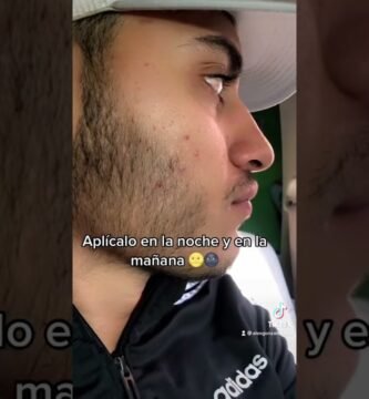 You Minox opiniones: ¿vale la pena la compra? efectividad comprobada