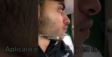 You Minox opiniones: ¿vale la pena la compra? efectividad comprobada