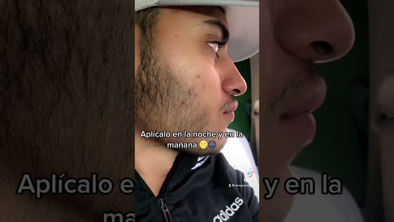 You Minox opiniones: ¿vale la pena la compra? efectividad comprobada